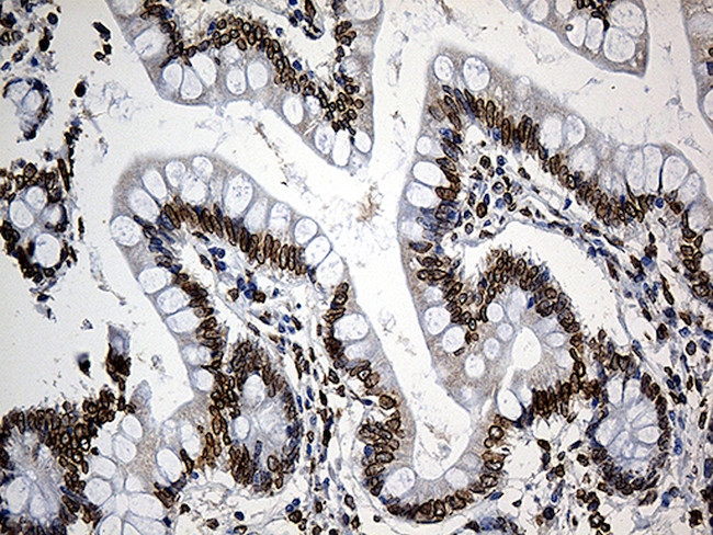 SLU7 Antibody in Immunohistochemistry (Paraffin) (IHC (P))