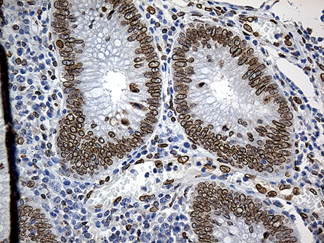 SLU7 Antibody in Immunohistochemistry (Paraffin) (IHC (P))