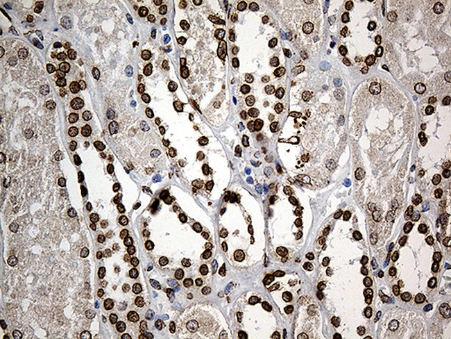 SLU7 Antibody in Immunohistochemistry (Paraffin) (IHC (P))