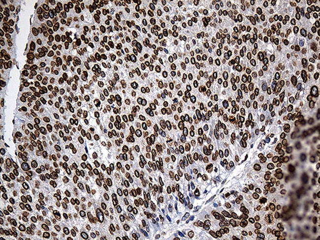 SLU7 Antibody in Immunohistochemistry (Paraffin) (IHC (P))