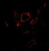 SLUG Antibody in Immunohistochemistry (IHC)