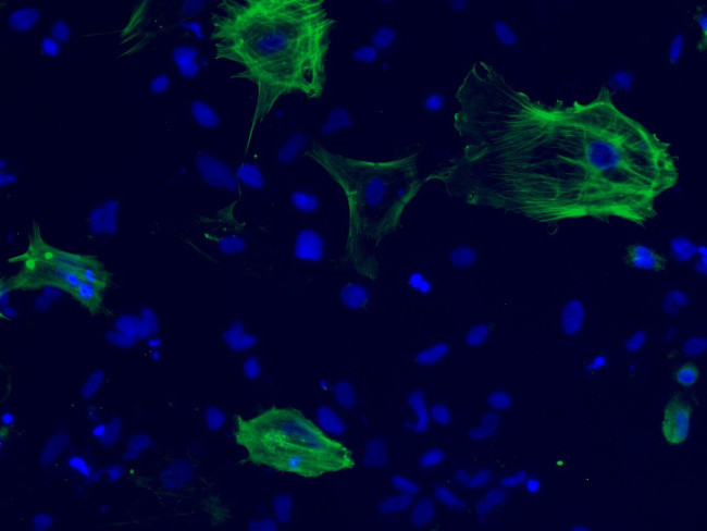 Alpha-Smooth Muscle Actin Antibody in Immunocytochemistry (ICC/IF)