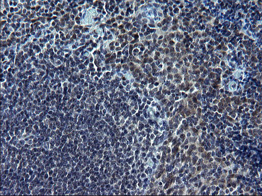 SMAD1 Antibody in Immunohistochemistry (Paraffin) (IHC (P))