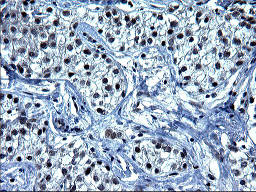 SMAD1 Antibody in Immunohistochemistry (Paraffin) (IHC (P))