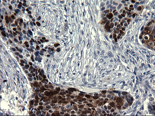 SMAD1 Antibody in Immunohistochemistry (Paraffin) (IHC (P))