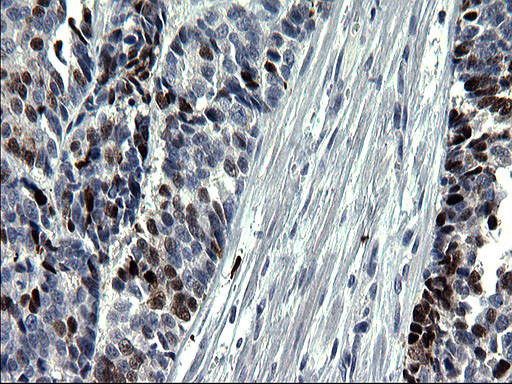 SMAD1 Antibody in Immunohistochemistry (Paraffin) (IHC (P))