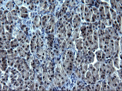 SMAD1 Antibody in Immunohistochemistry (Paraffin) (IHC (P))