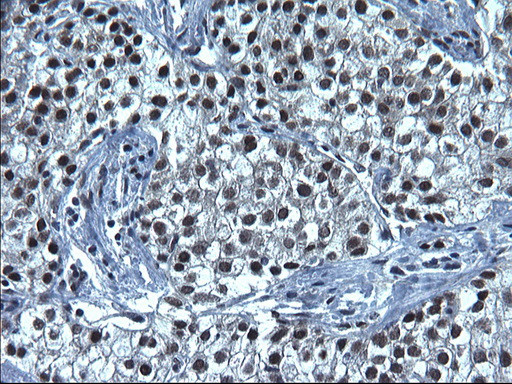 SMAD1 Antibody in Immunohistochemistry (Paraffin) (IHC (P))