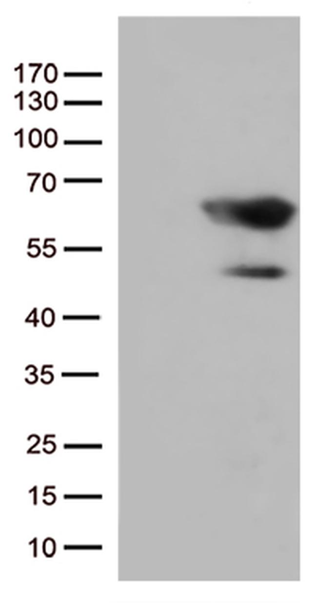 SMAD1 Antibody in Western Blot (WB)