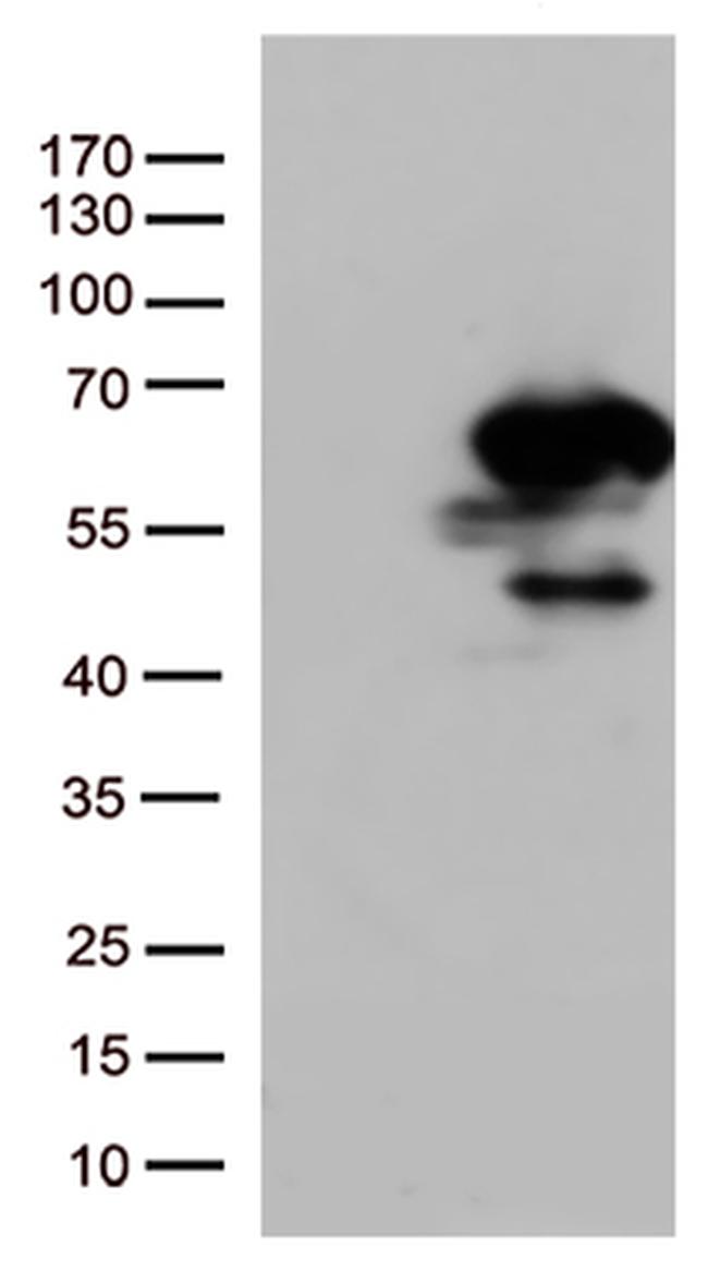 SMAD1 Antibody in Western Blot (WB)