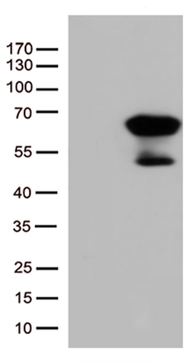 SMAD1 Antibody in Western Blot (WB)