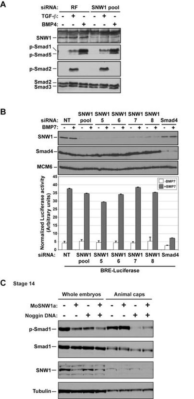 SMAD1 Antibody in Western Blot (WB)