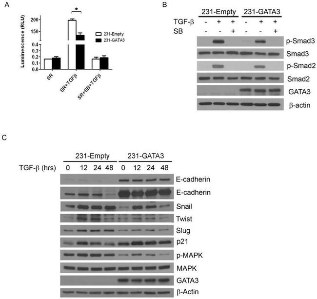 SMAD1 Antibody in Western Blot (WB)