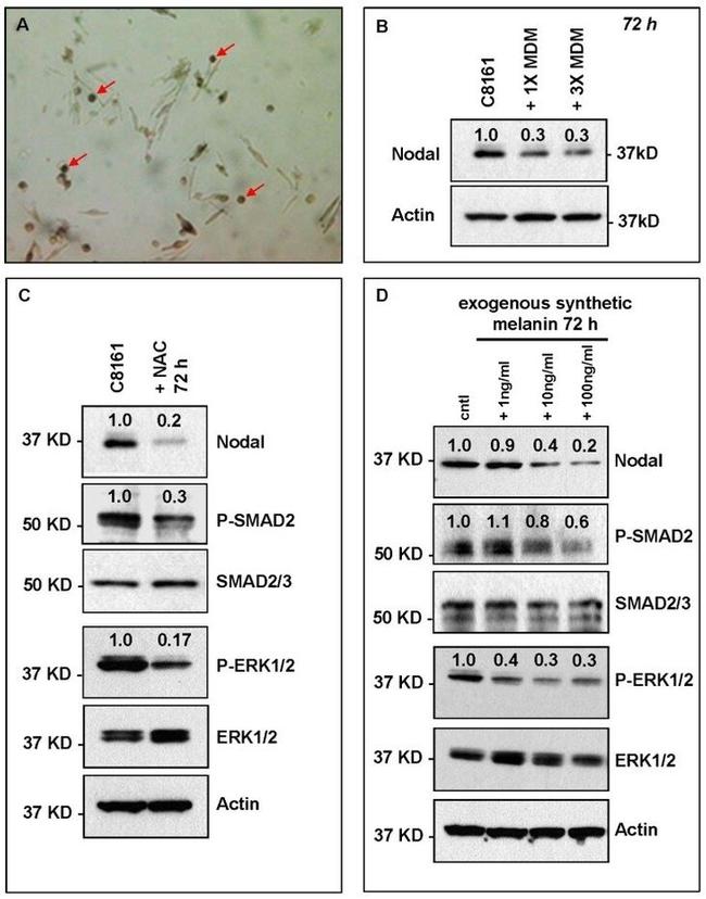 ERK1/ERK2 Antibody in Western Blot (WB)