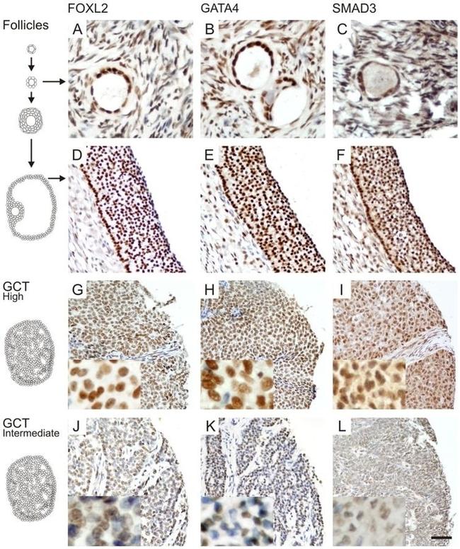 SMAD3 Antibody in Immunohistochemistry (IHC)