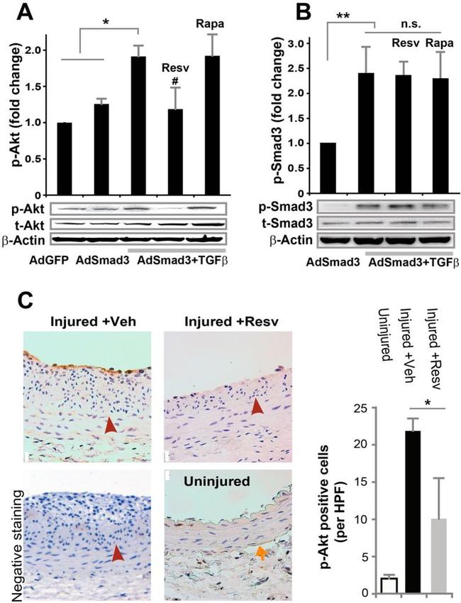 SMAD3 Antibody in Western Blot (WB)