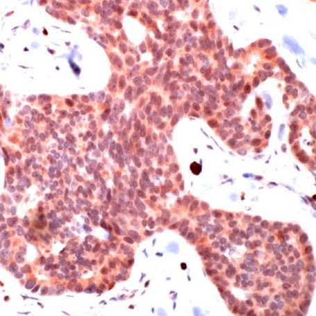 SMAD3 Antibody in Immunohistochemistry (Paraffin) (IHC (P))