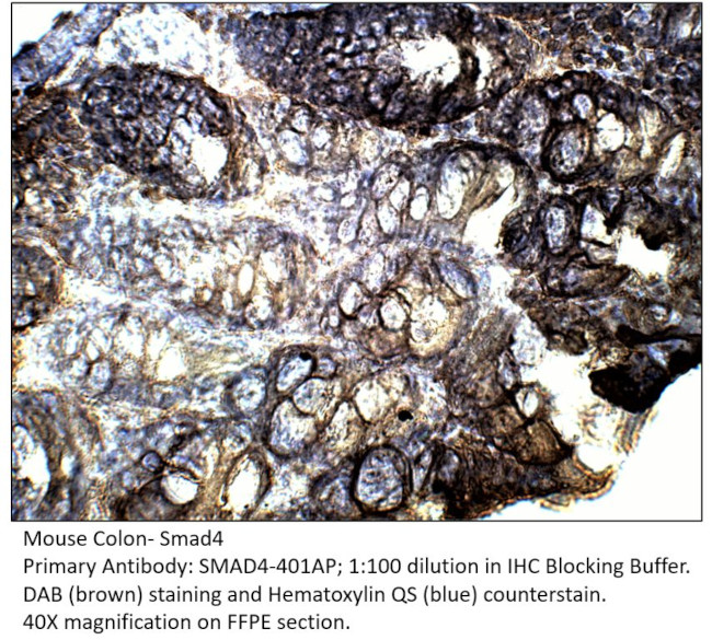 Smad4 Antibody in Immunohistochemistry (IHC)