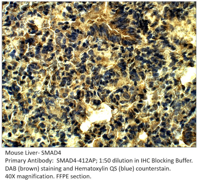 Smad4 Antibody in Immunohistochemistry (IHC)