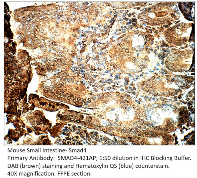 Smad4 Antibody in Immunohistochemistry (IHC)