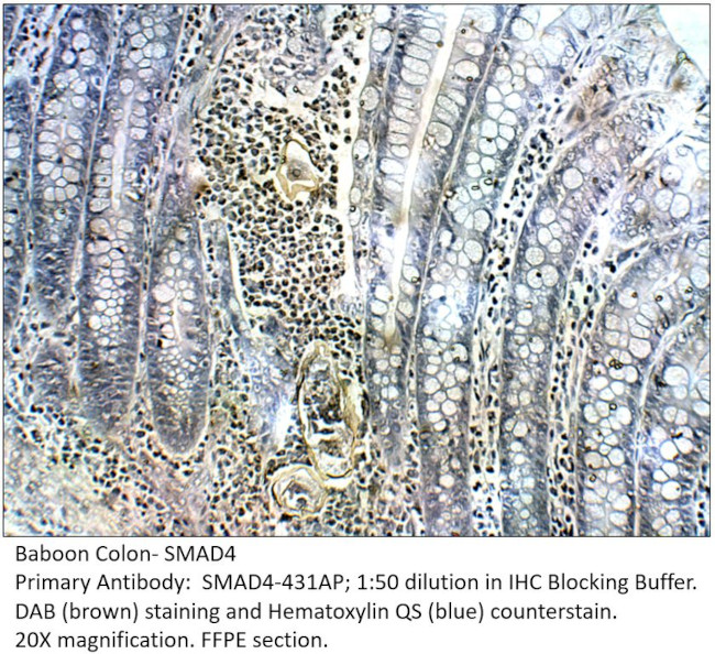 Smad4 Antibody in Immunohistochemistry (IHC)