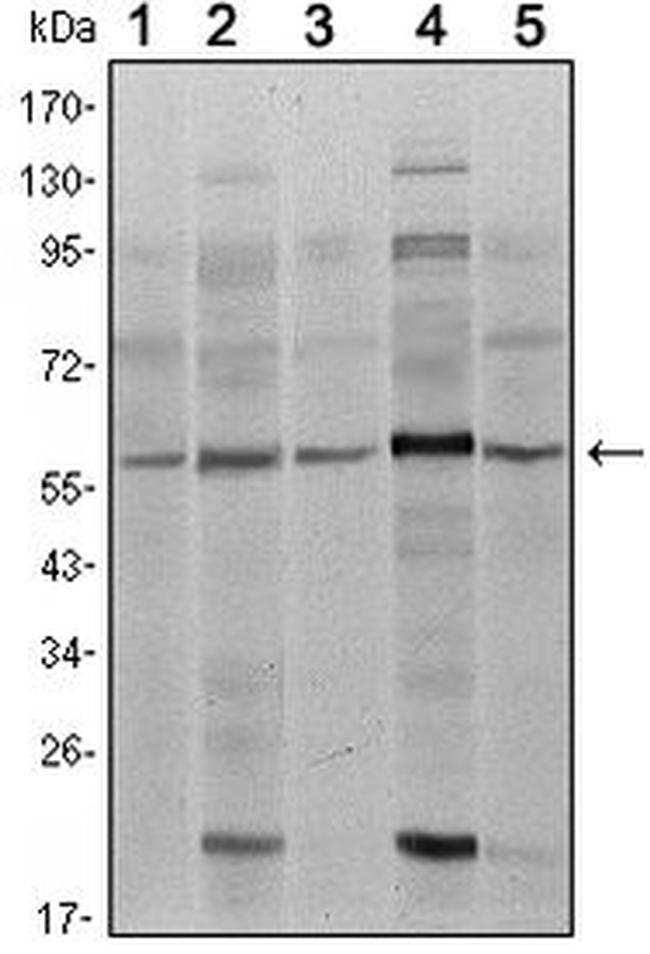 SMAD4 Antibody in Western Blot (WB)