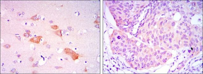 SMAD5 Antibody in Immunohistochemistry (Paraffin) (IHC (P))