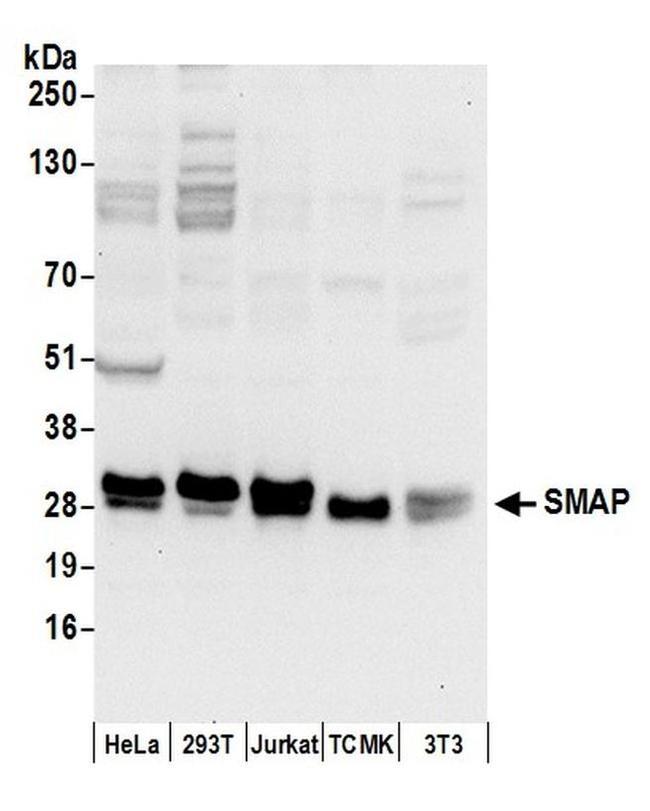 SMAP Antibody in Western Blot (WB)