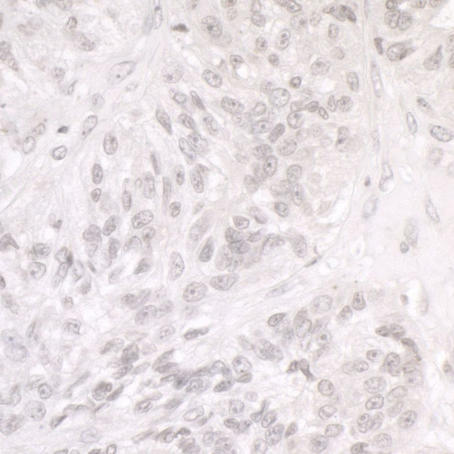 SMARCA1/SNF2L Antibody in Immunohistochemistry (IHC)