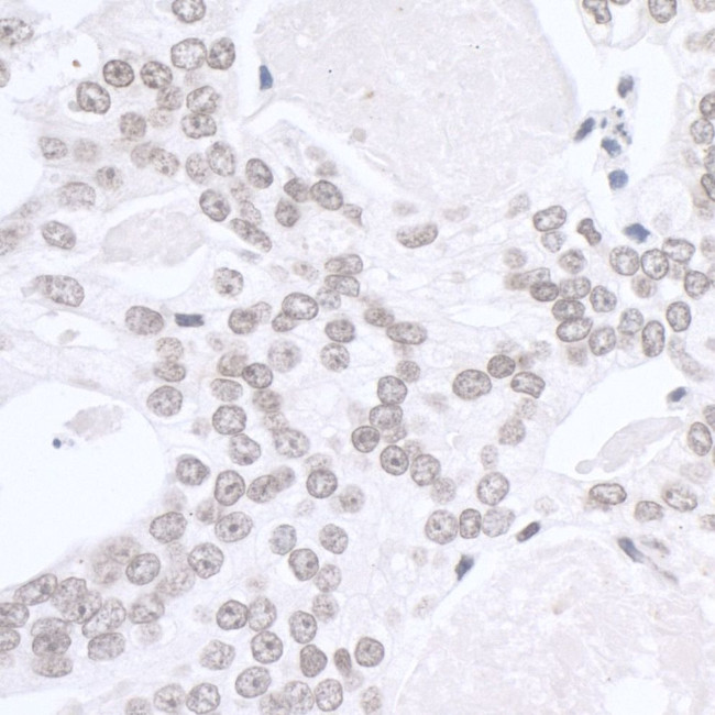 SMARCA1/SNF2L Antibody in Immunohistochemistry (IHC)