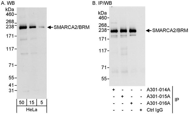 SMARCA2/BRM Antibody in Western Blot (WB)