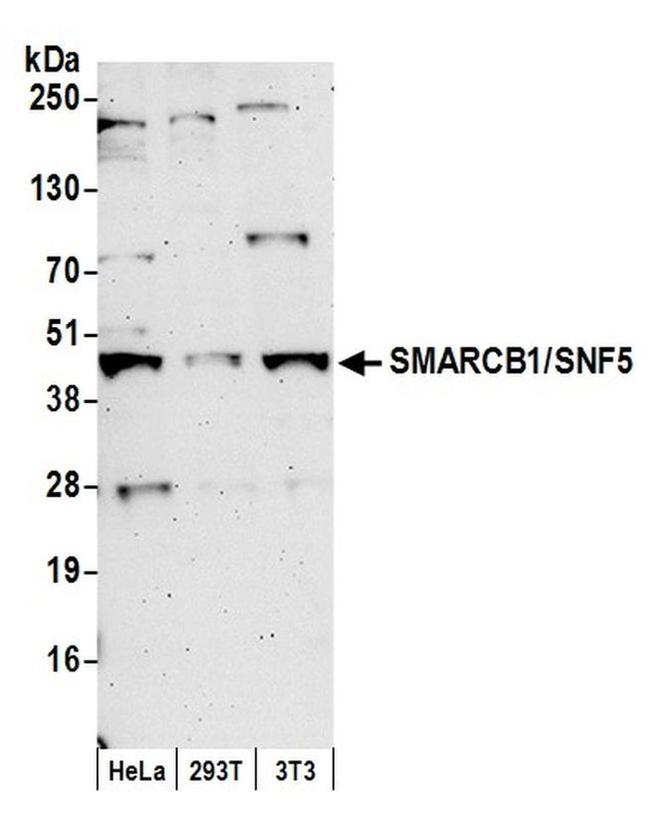 SMARCB1/SNF5 Antibody in Western Blot (WB)