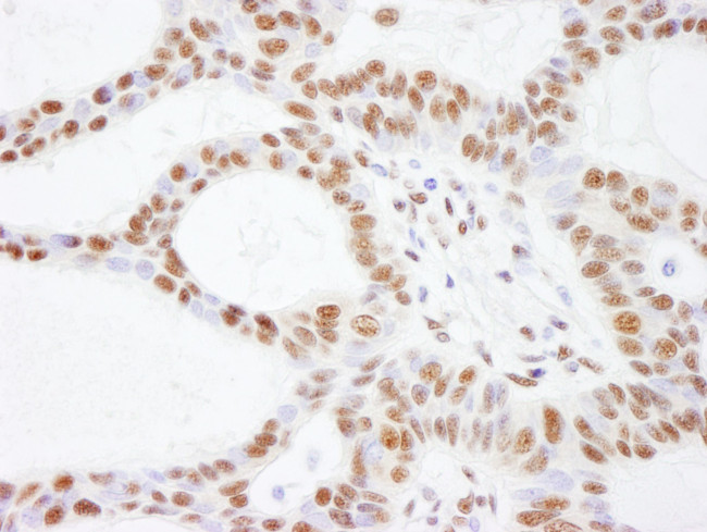 SMARCC2/BAF170 Antibody in Immunohistochemistry (IHC)