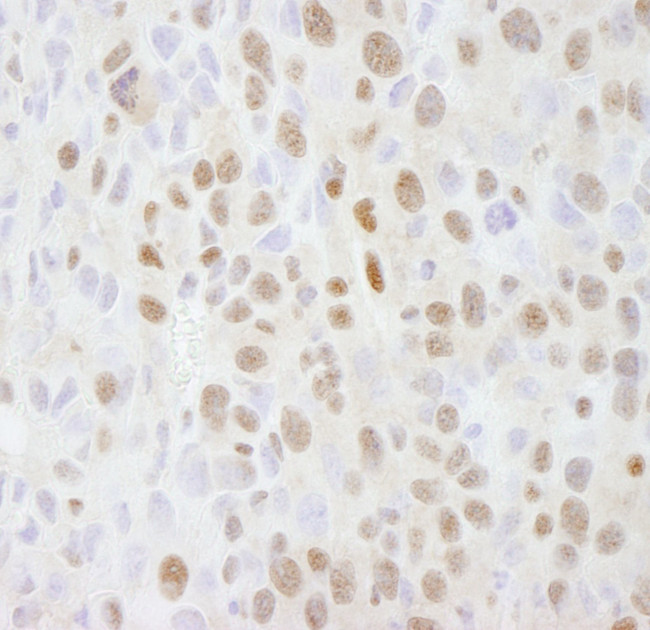 SMARCC2/BAF170 Antibody in Immunohistochemistry (IHC)