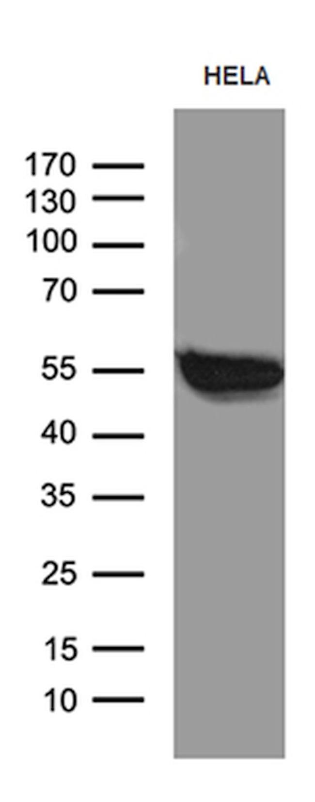 SMARCD3 Antibody in Western Blot (WB)