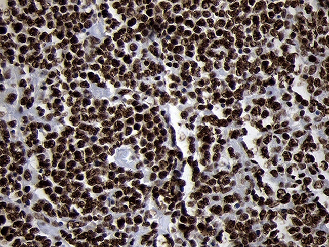SMC1A Antibody in Immunohistochemistry (Paraffin) (IHC (P))