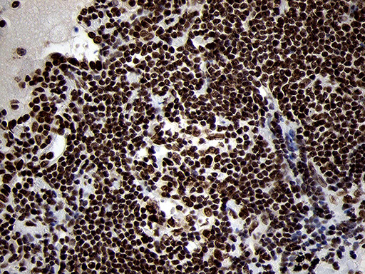 SMC1A Antibody in Immunohistochemistry (Paraffin) (IHC (P))