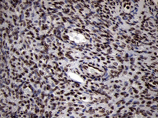 SMC1A Antibody in Immunohistochemistry (Paraffin) (IHC (P))