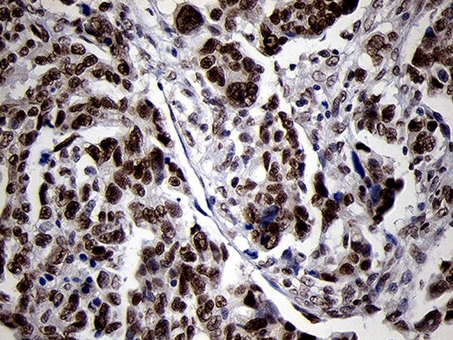 SMC1A Antibody in Immunohistochemistry (Paraffin) (IHC (P))