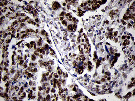 SMC1A Antibody in Immunohistochemistry (Paraffin) (IHC (P))