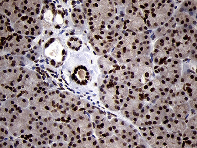 SMC1A Antibody in Immunohistochemistry (Paraffin) (IHC (P))