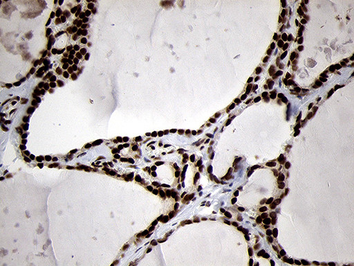 SMC1A Antibody in Immunohistochemistry (Paraffin) (IHC (P))