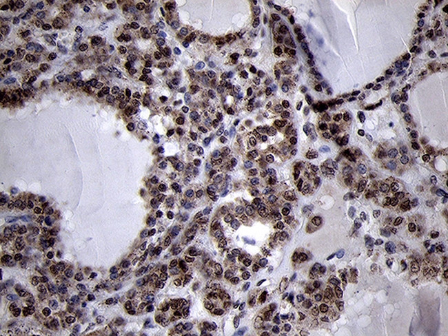 SMC1A Antibody in Immunohistochemistry (Paraffin) (IHC (P))