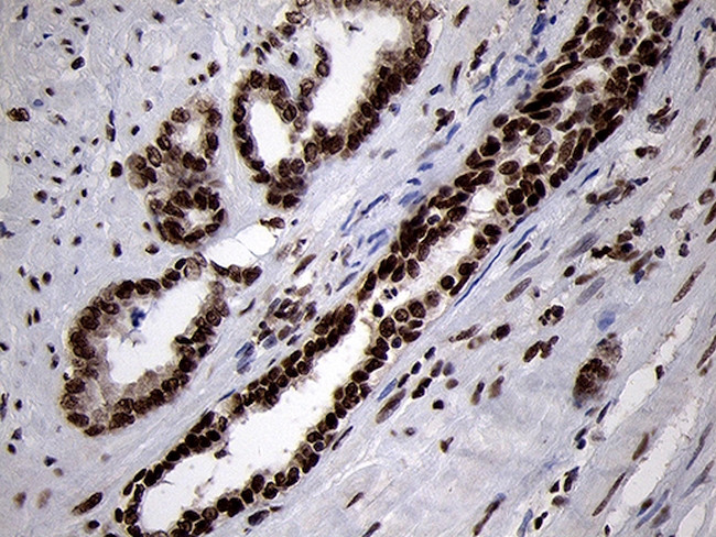 SMC1A Antibody in Immunohistochemistry (Paraffin) (IHC (P))