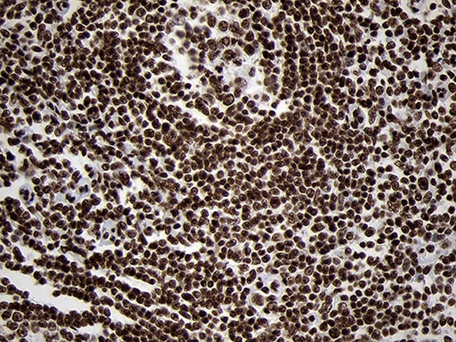 SMC1A Antibody in Immunohistochemistry (Paraffin) (IHC (P))