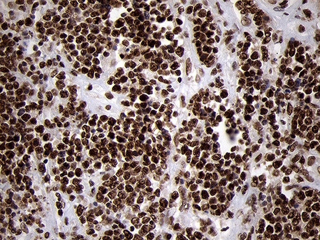 SMC1A Antibody in Immunohistochemistry (Paraffin) (IHC (P))