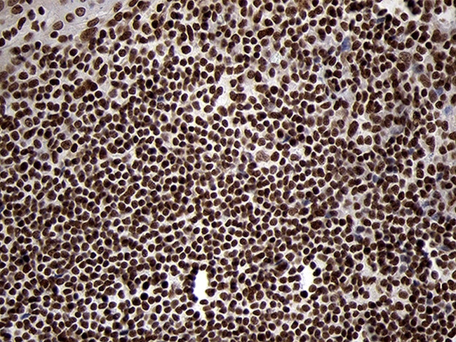 SMC1A Antibody in Immunohistochemistry (Paraffin) (IHC (P))