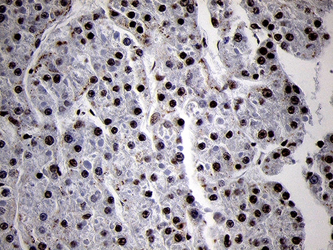 SMC1A Antibody in Immunohistochemistry (Paraffin) (IHC (P))