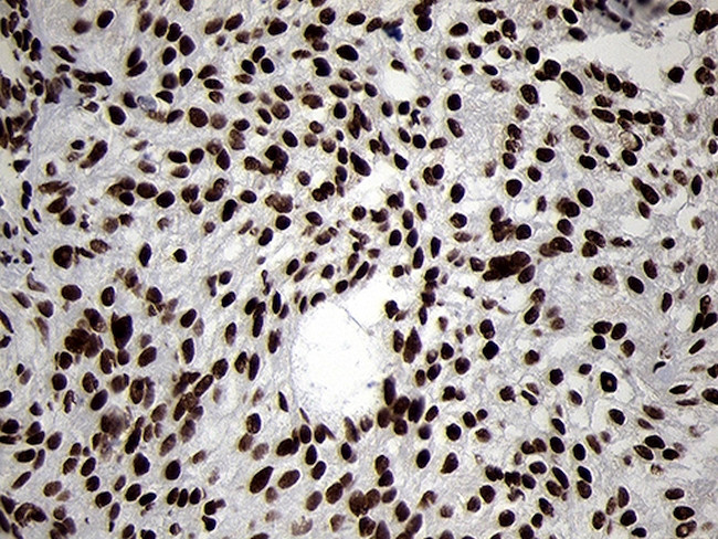 SMC1A Antibody in Immunohistochemistry (Paraffin) (IHC (P))