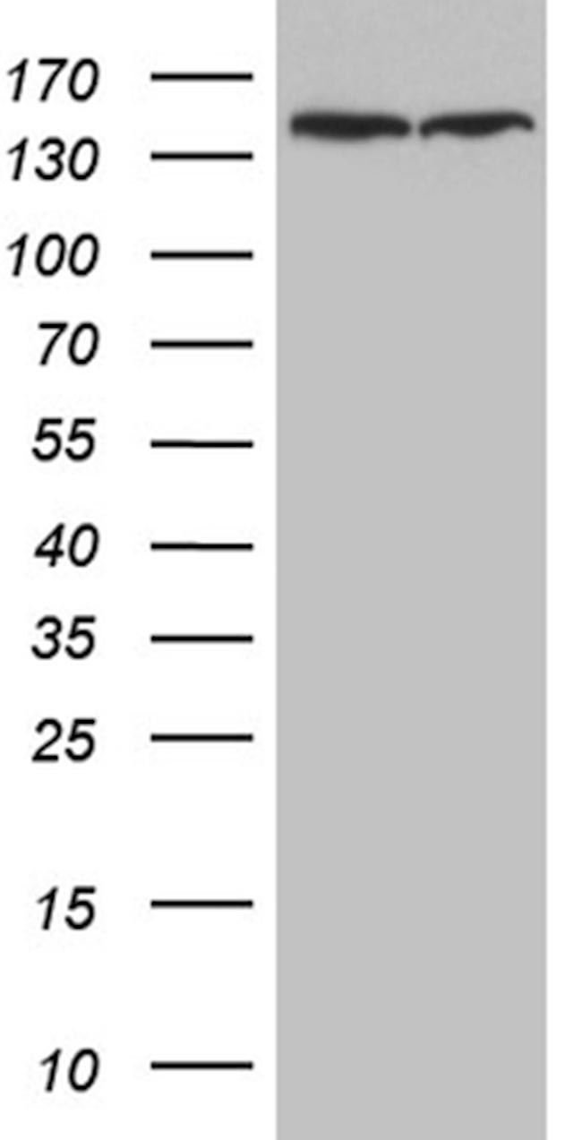 SMC1A Antibody in Western Blot (WB)